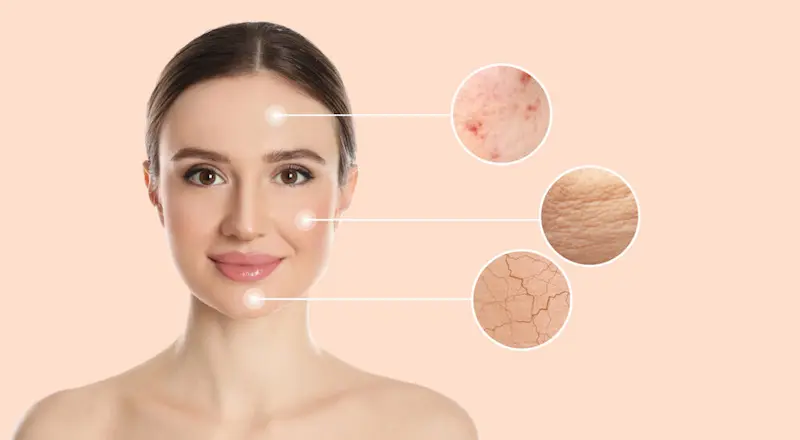understanding your skin type